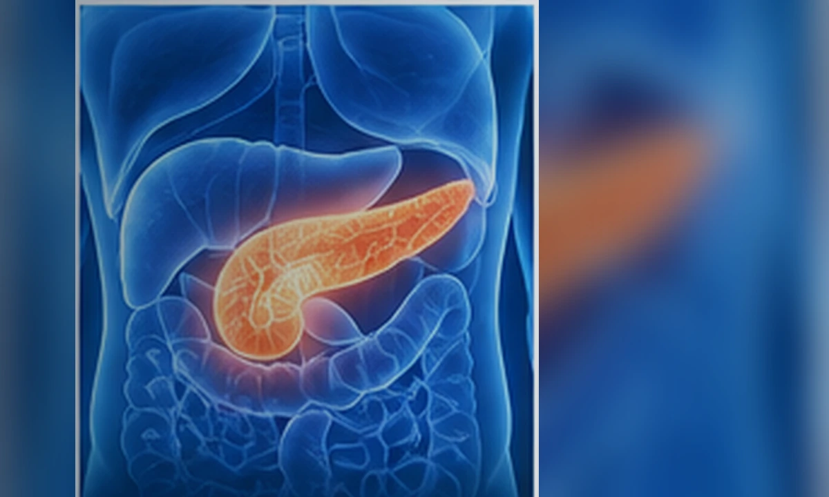 Medical illustration of type 2 diabetes and pancreatic function